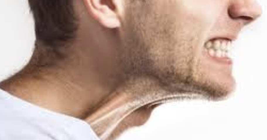 Jaw clenching / bruxism